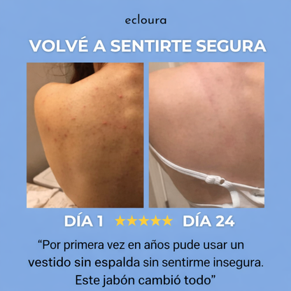 Ecloura Jabón AntiAcné de Espalda y Gluteos