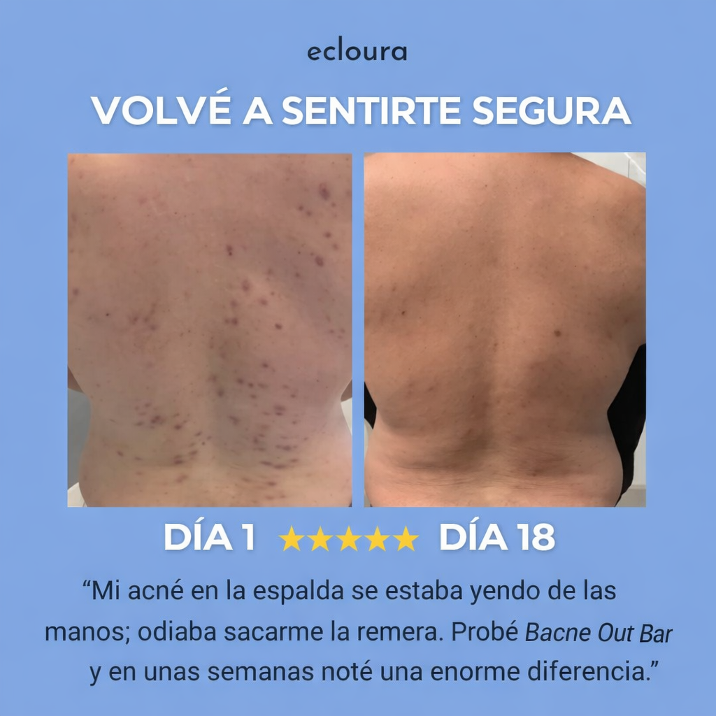Ecloura Jabón AntiAcné de Espalda y Gluteos
